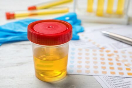 L'examen cytobactériologique des urines ECBU
