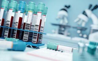 Ferritine : comprendre vos résultats