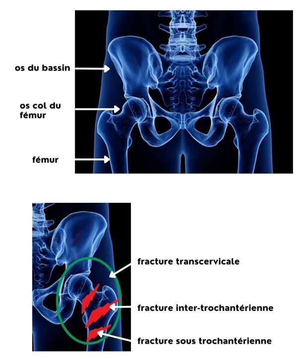 Anatomie de la hanche