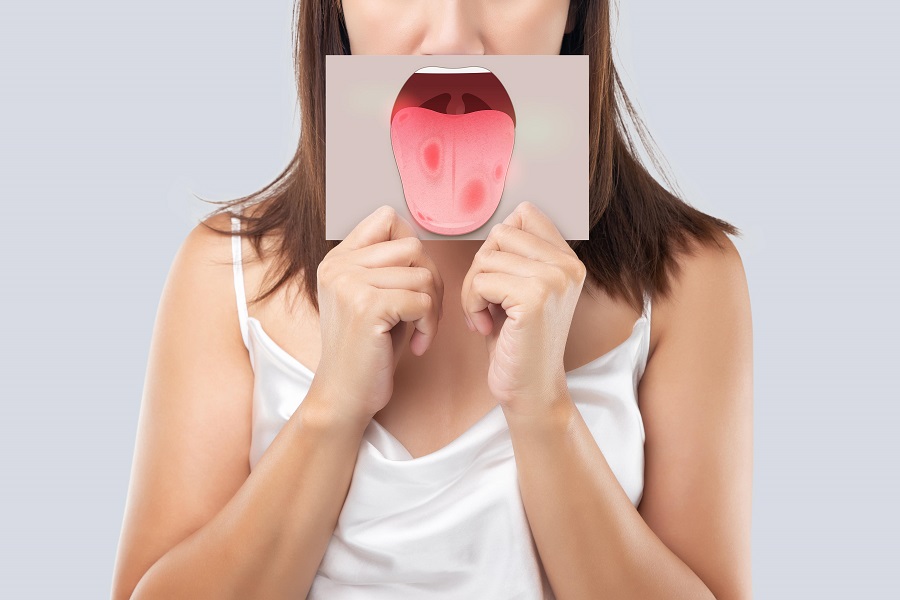 cancer de la langue, causes, diagnostic, traitements et pronostic