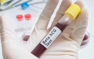 dosage hormone bêta HCG