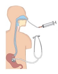 Test sonde nasogastrique