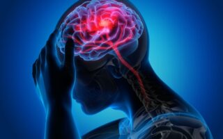AVC AIT accident vasculaire cérébral facteurs de risque, diagnostic et traitement