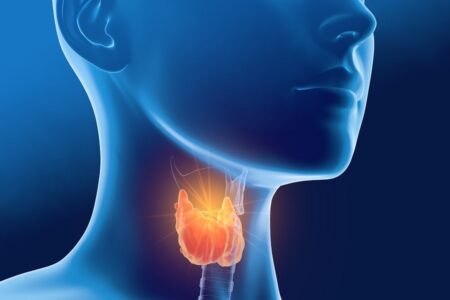 Hyperthyroidie