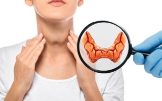 Hypothyroidie