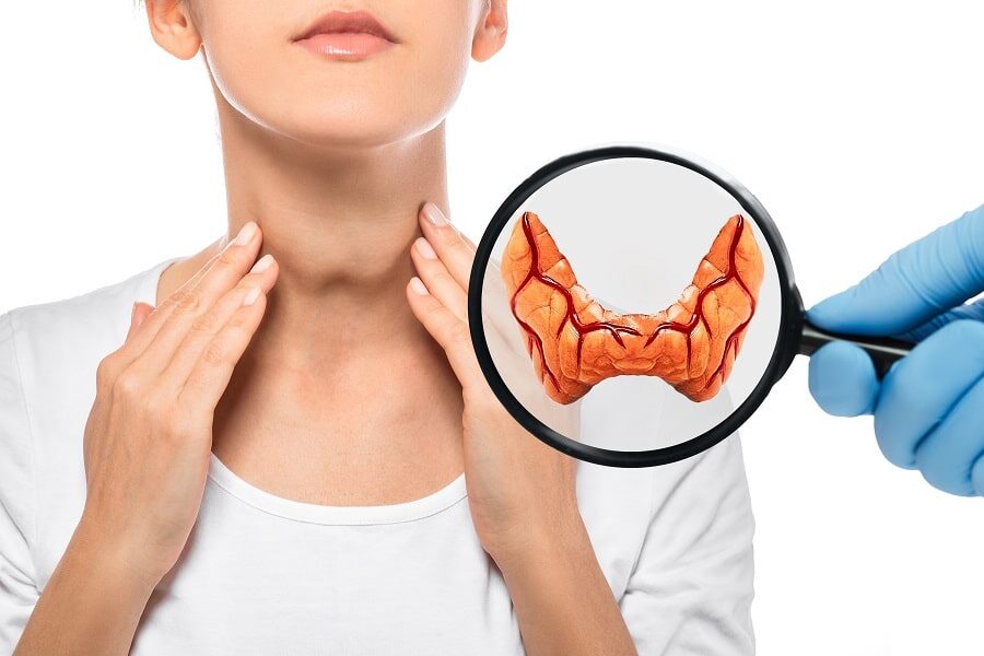 Hypothyroidie