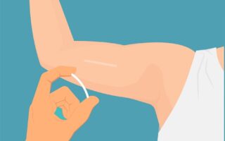 Implant contraceptif pose et retrait